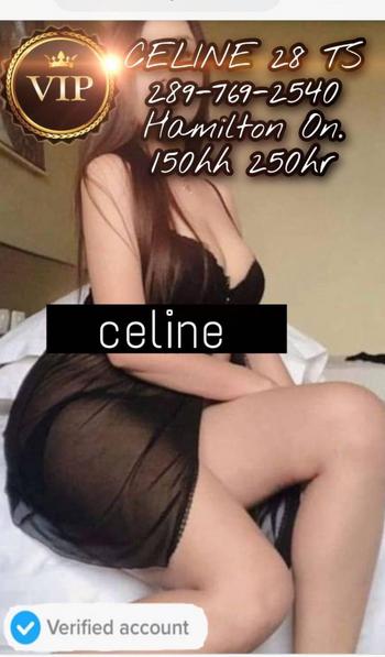 CelineTS , 28 Asian female escort, Hamilton